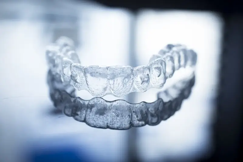 Ile kosztują nakładki Invisalign?