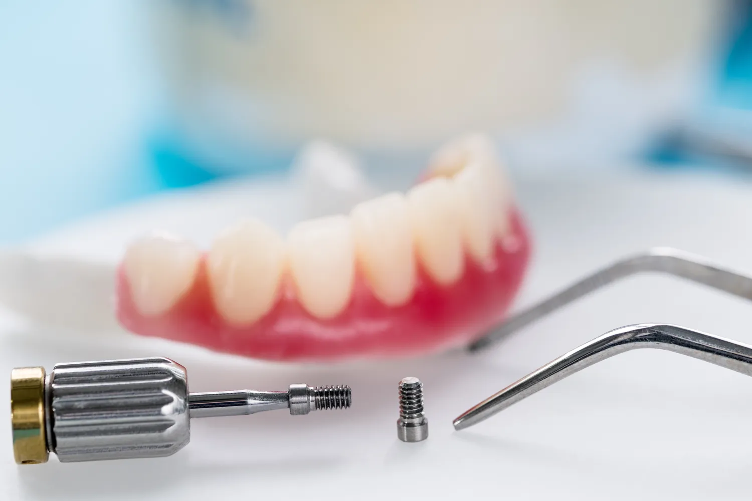 Rodzaje implantów zębowych