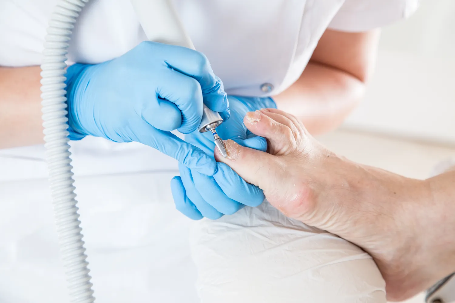 Pedicure leczniczy - co na ten temat wiedzieć trzeba?