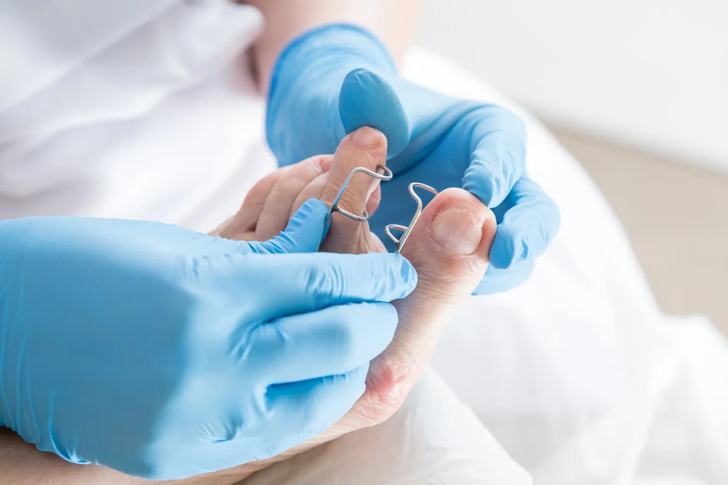 Podologia - zdrowe i ładne stopy